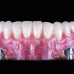 Why Some Dental Centers Are Booked Months In Advance
