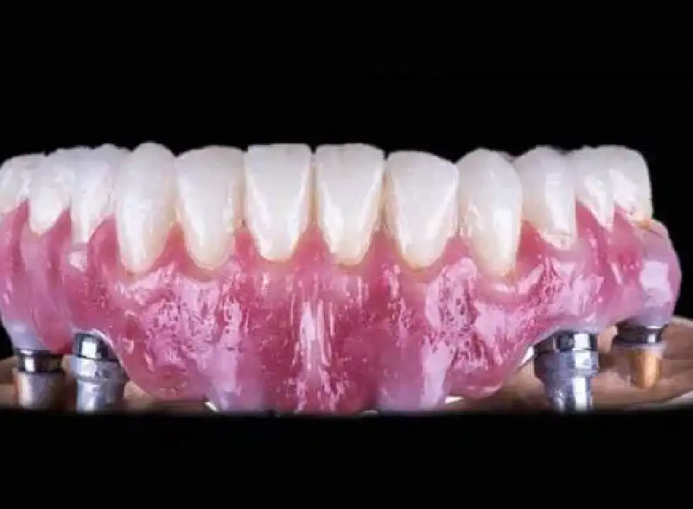 Why Some Dental Centers Are Booked Months In Advance